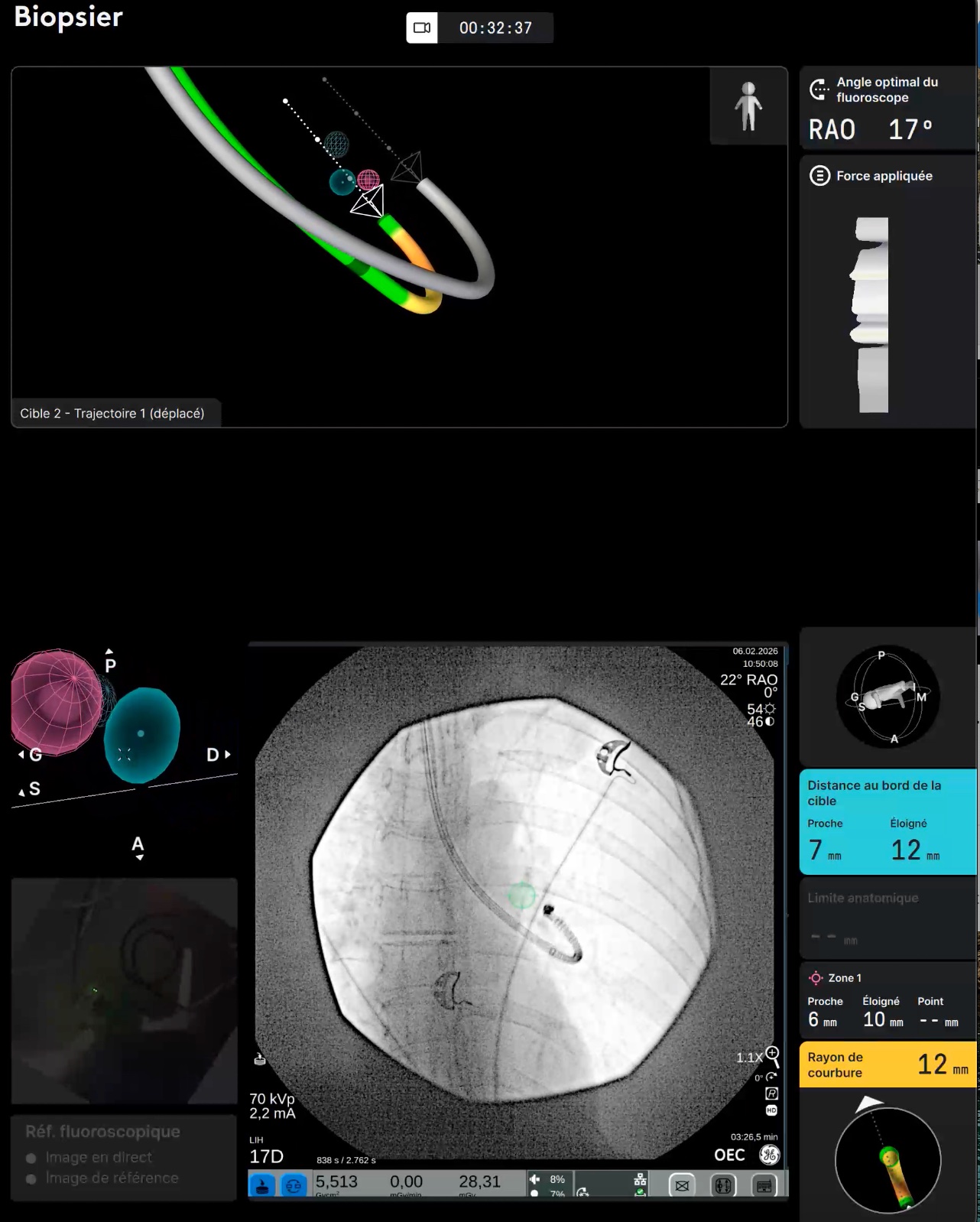 Ion navigation and cone-beam CT targeting